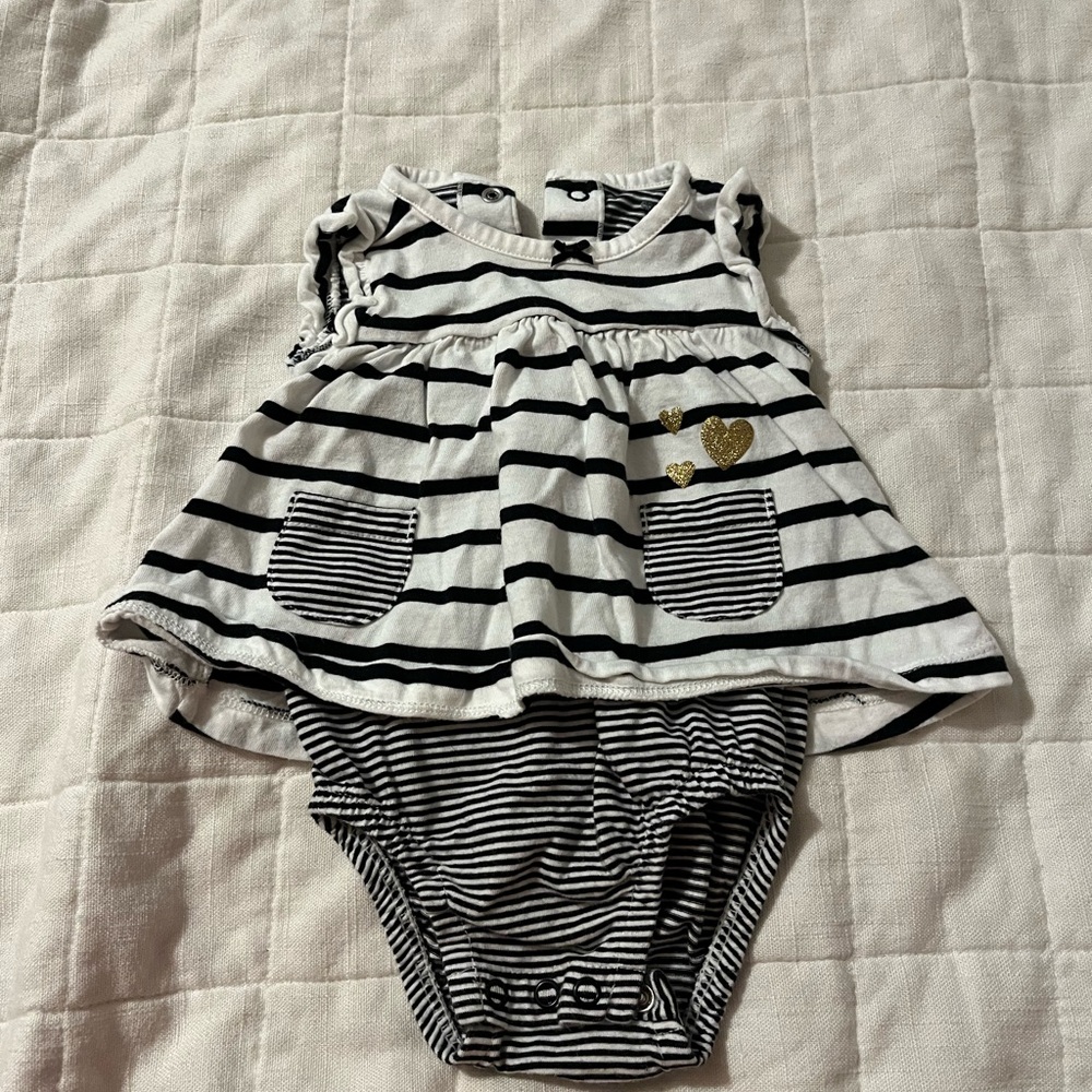 Striped Black & White Baby Dress Bodysuit - Kids Accessories